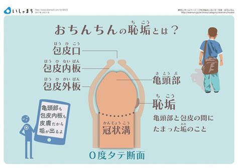 ちんこカリとは|【泌尿器専門医が解説】異物を入れずにカリ高ペニスを作る唯一。